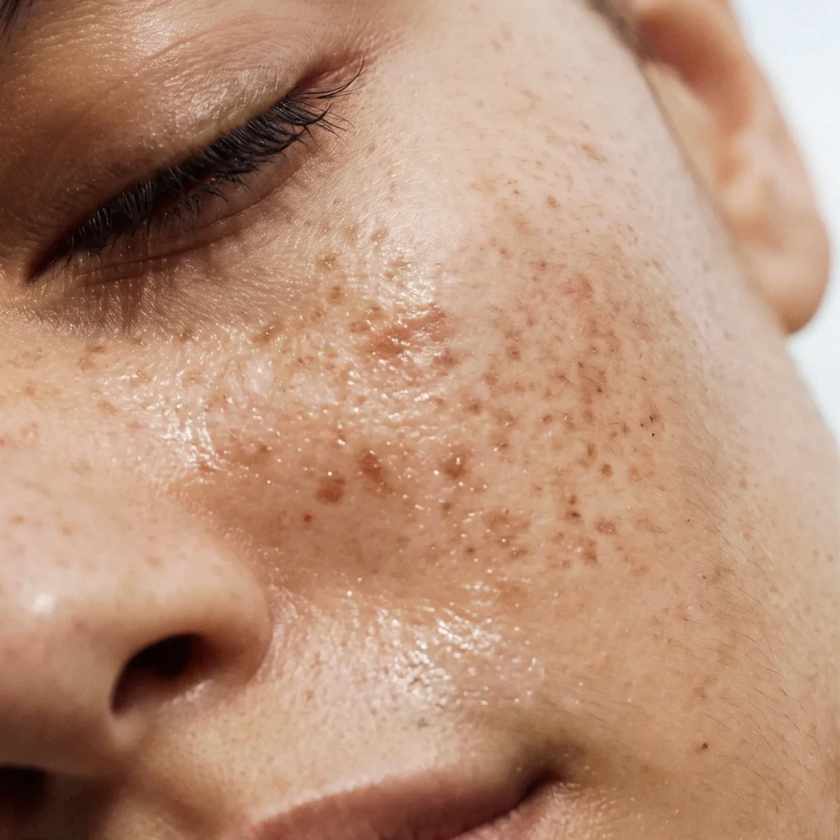 Clear skin exfoliërend serum